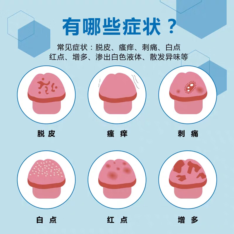 邦士银男士抗箘康归严宁护康宁龟鬼头包皮男性护理清洗液 一瓶好转装