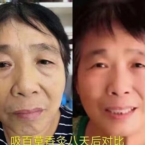 百草香灸李大为古彝百草香灸提l高l免l疫l力养生艾灸排l湿l排l寒散装