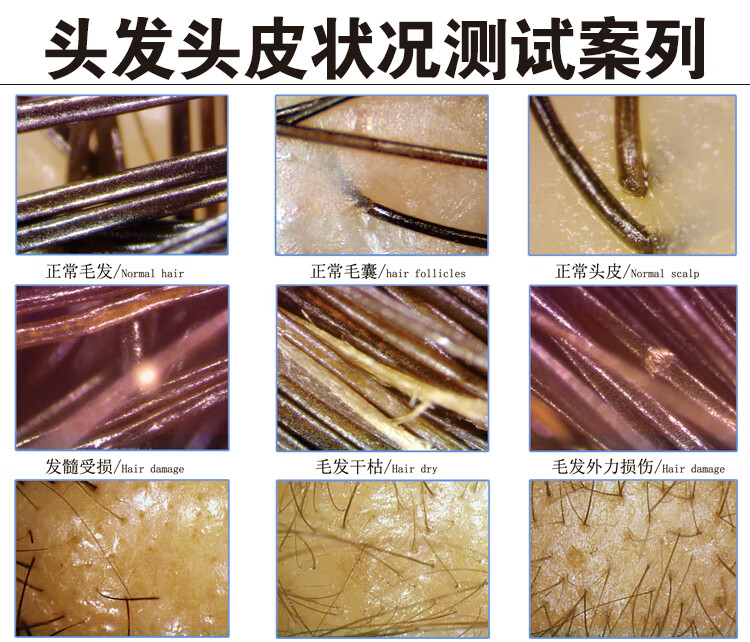 頭皮毛囊檢測儀頭髮臉部皮膚分析儀器理髮店高清帶箱式檢測儀單手柄