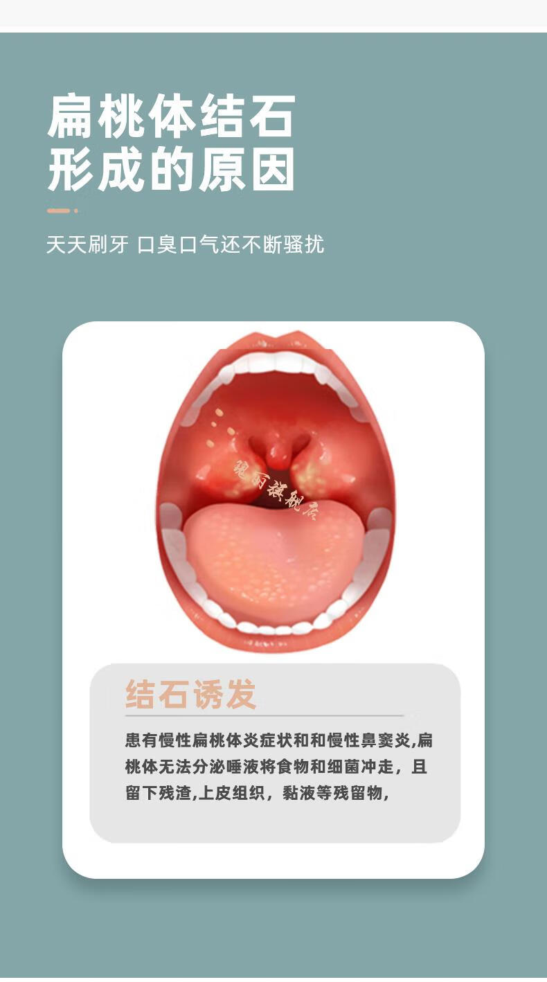 邦兴晖扁桃体结石去除工具家用电动吸取器扁桃腺结石清除器口腔隐窝结石多功能吸器 图片价格品牌报价 京东