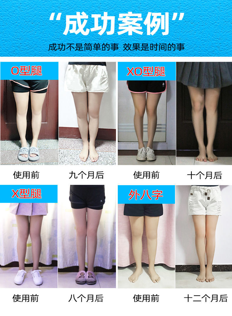 磁石矫正鞋垫o型腿矫正 o形腿xo型x型腿小腿外翻脚纠正腿型 顶配双磁