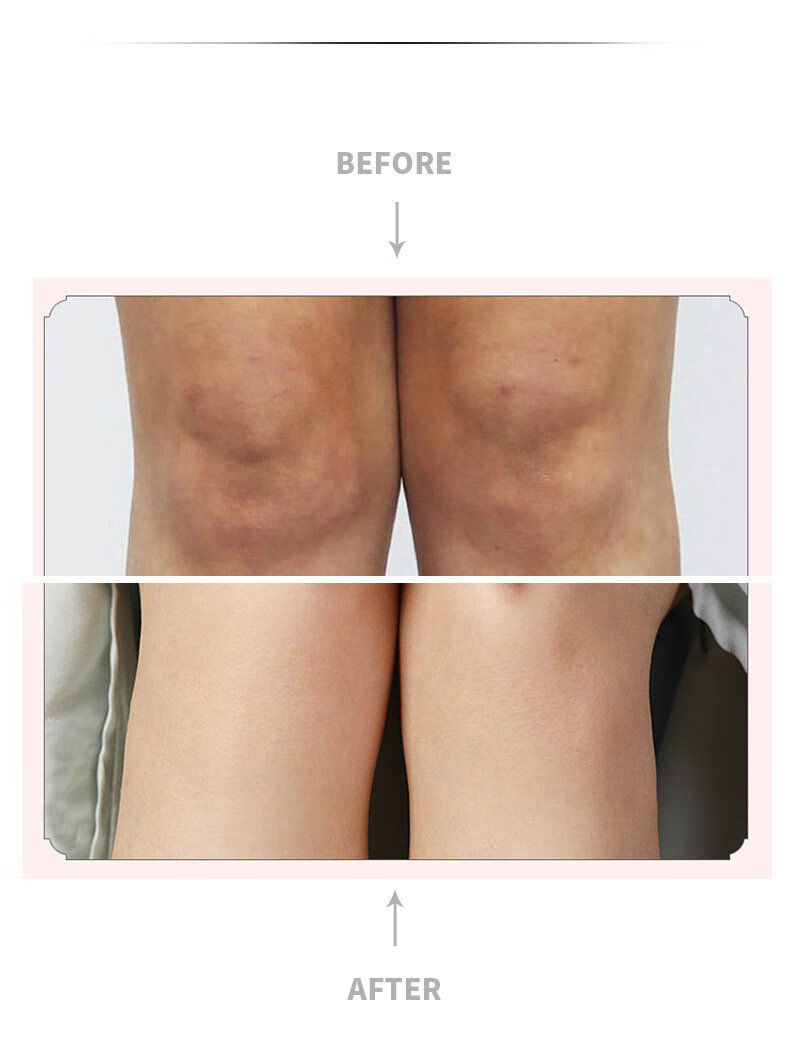 关节镁白神器去i黑色素沉淀黑脖子手肘胳膊肘膝盖腋下黑印去除 70g