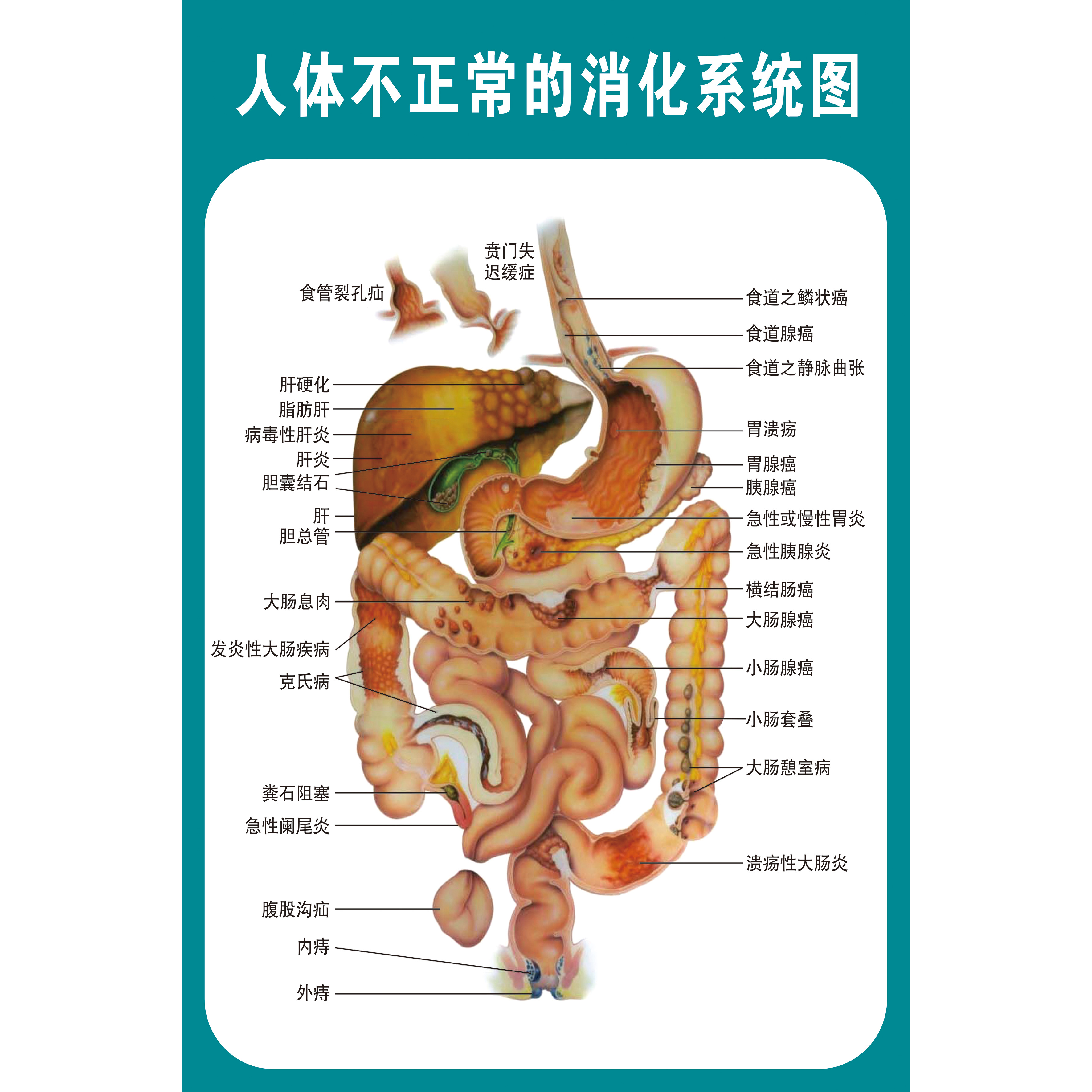 人体结构骨骼内脏消化神经血管肝胃生殖解剖系统示意图医学挂图胃部