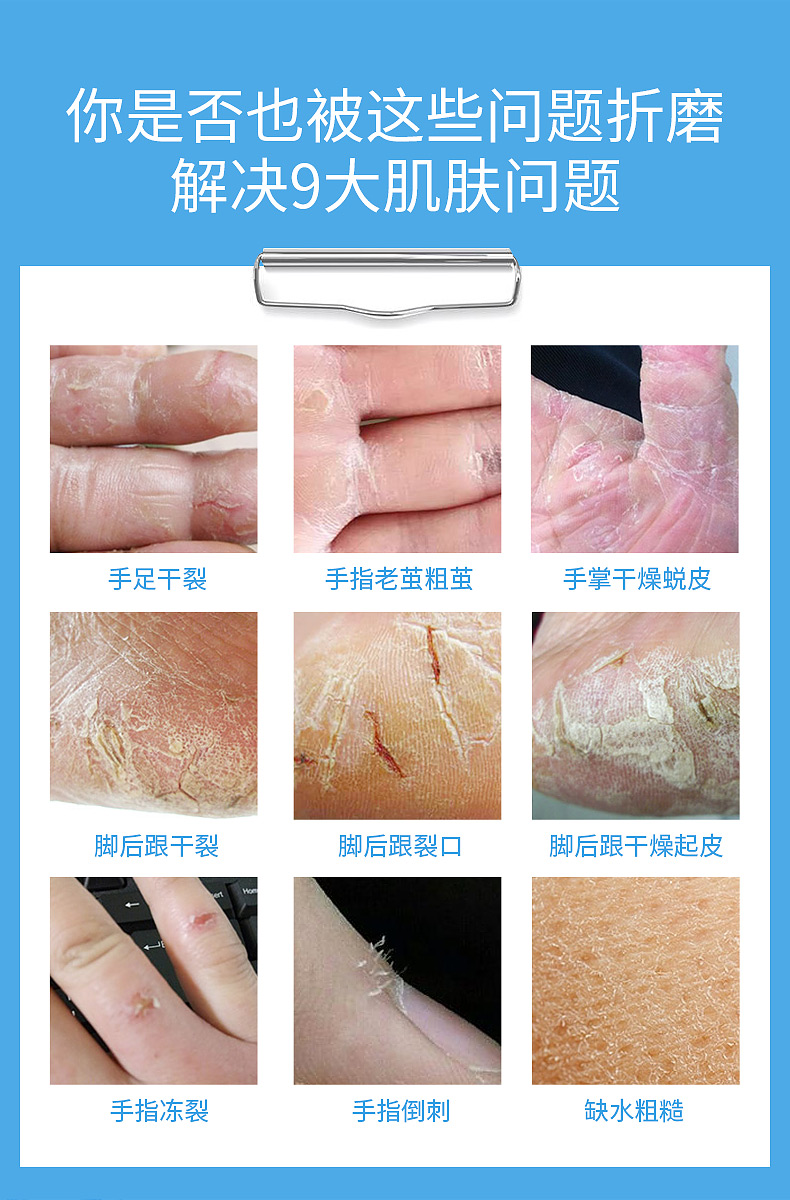 冰王乐施皲裂修护型擦伤口护理软膏50g手脚后跟干裂口龟裂膏脱皮t5