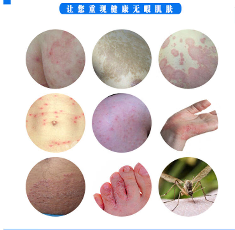 迪肤霜成人乳膏止痒软膏皮肤牛1盒体验