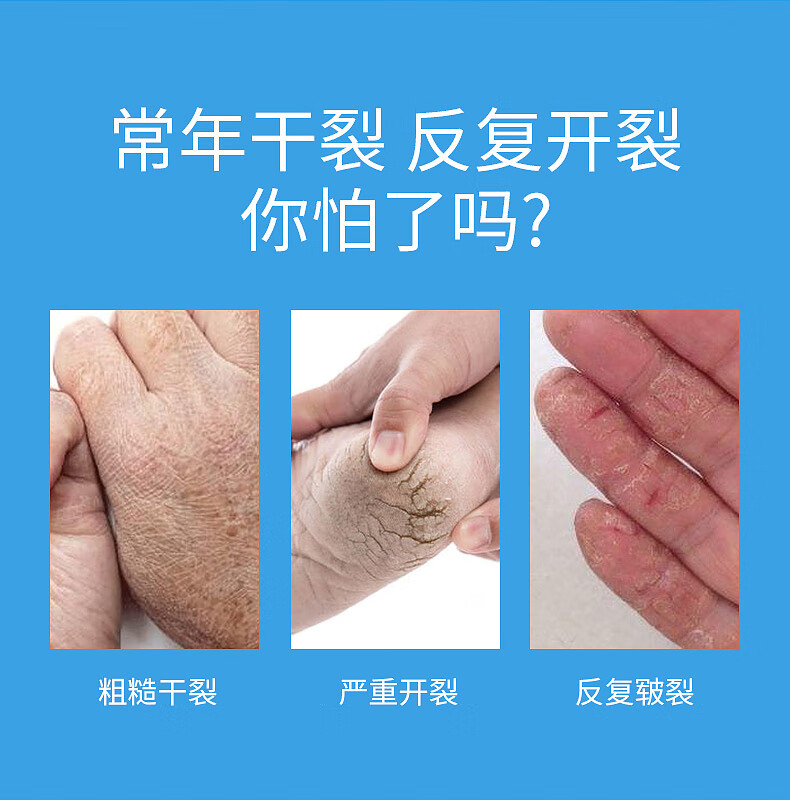 冰王乐施皲裂修护型擦伤口护理软膏50g手脚后跟干裂口龟裂膏脱皮t5