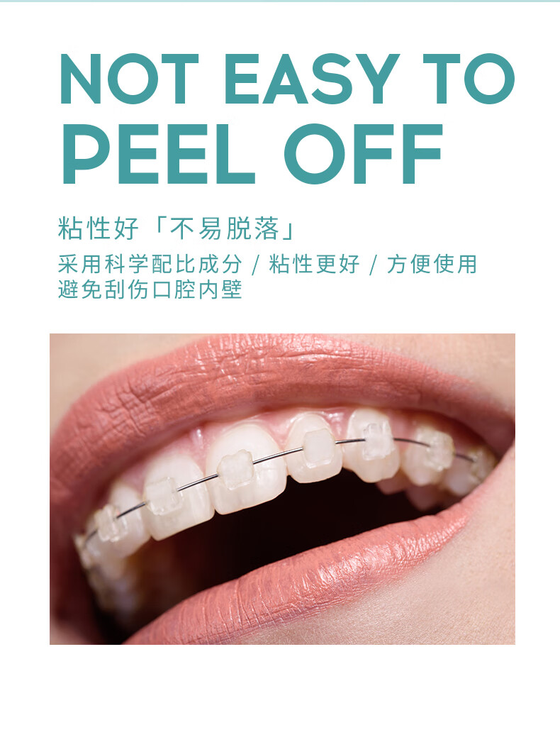 2022新款meyarn米妍正畸保护蜡牙齿粘膜牙箍托槽口腔黏膜防磨嘴牙套蜡