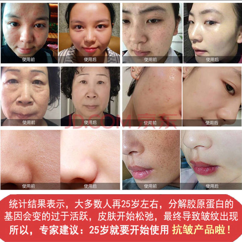 法意兰夏天清爽芦荟面膜补水保湿面膜贴护肤品+蜗牛美白祛斑淡化痘印 3盒芦荟面膜(30片)