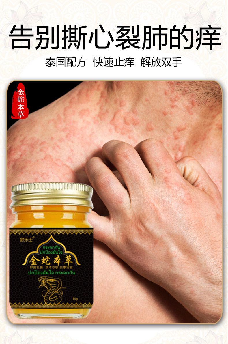 鈇乐士金蛇本草牛i皮v癣抑i菌膏专用头i癣毛囊炎皮肤瘙痒湿v疹股v癣