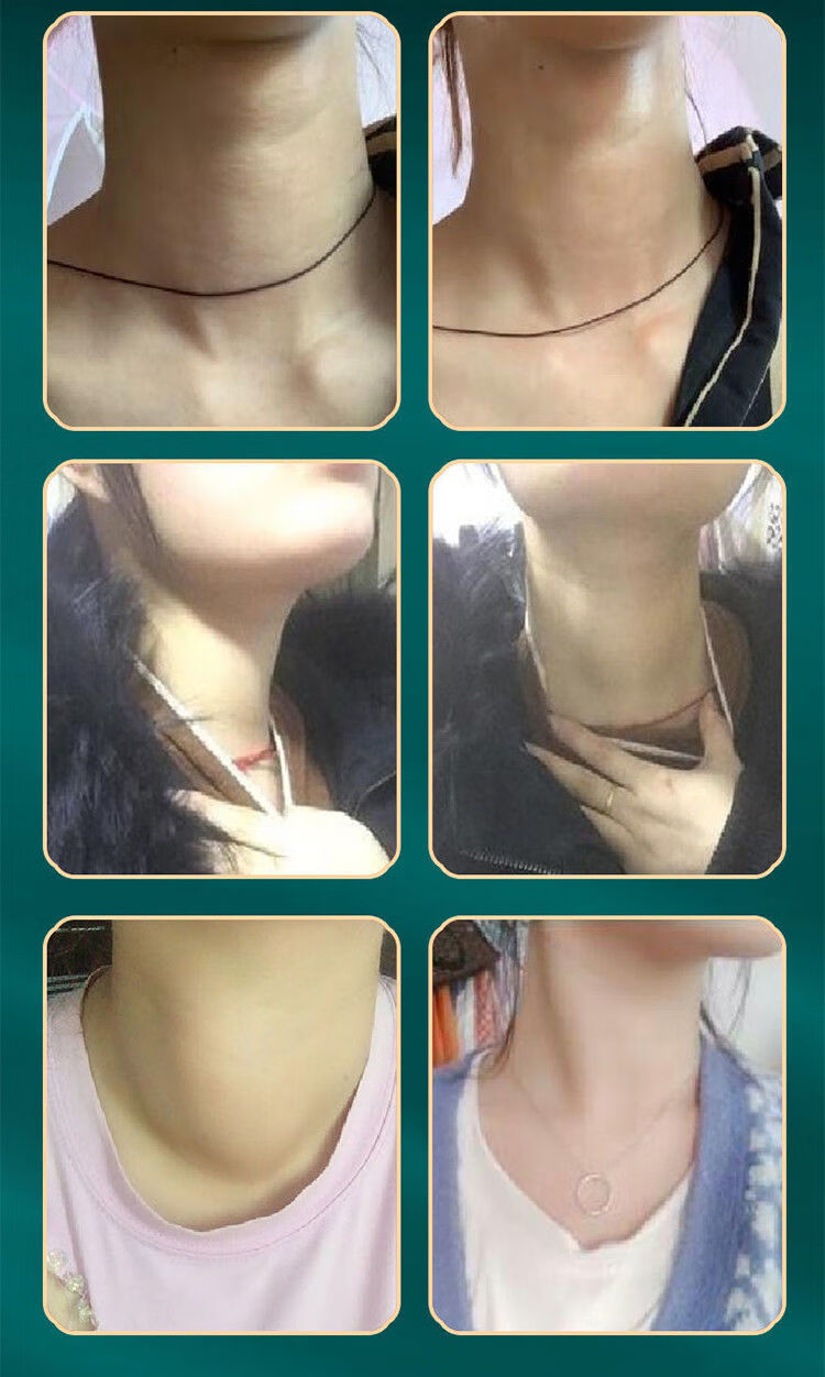 结节肿大甲亢甲减脖子粗桥本甲状腺散结冷敷贴极速散结2盒强力散结