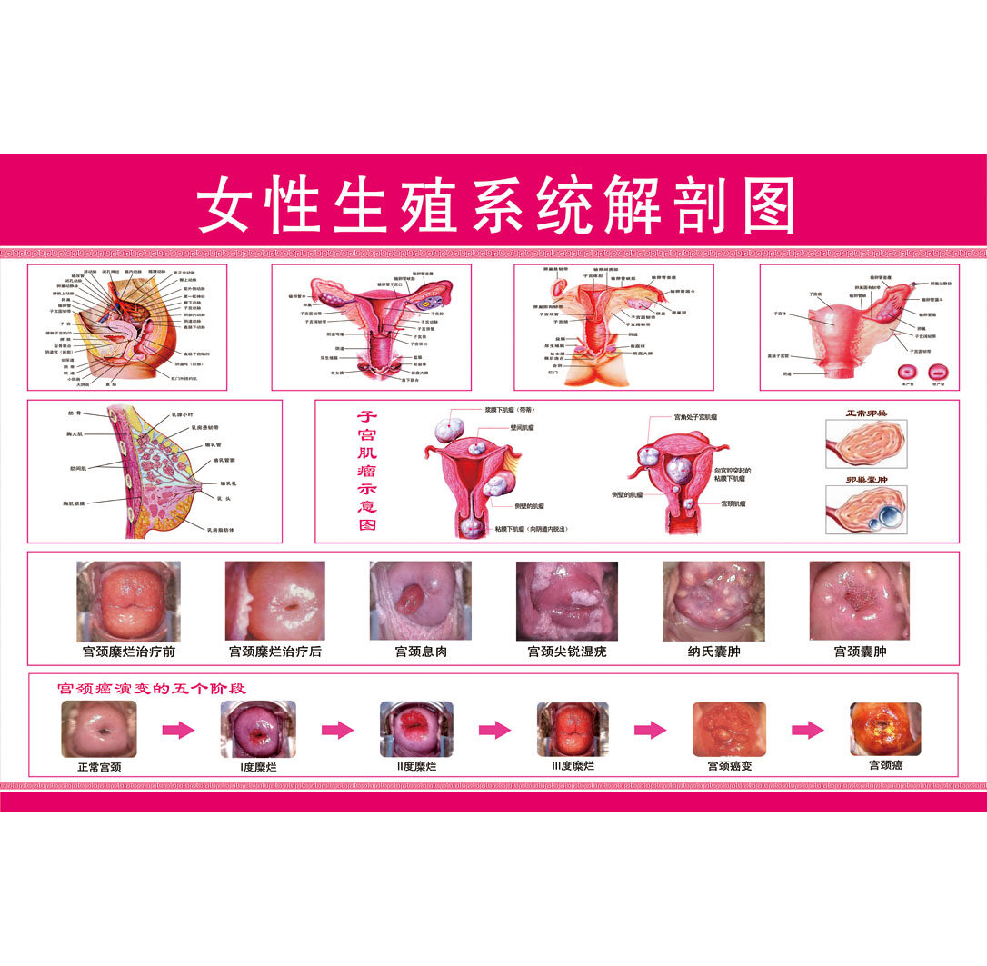 女性生殖器系统解剖图医院宣传挂图子宫妇科海报宫颈疾病示意图女性