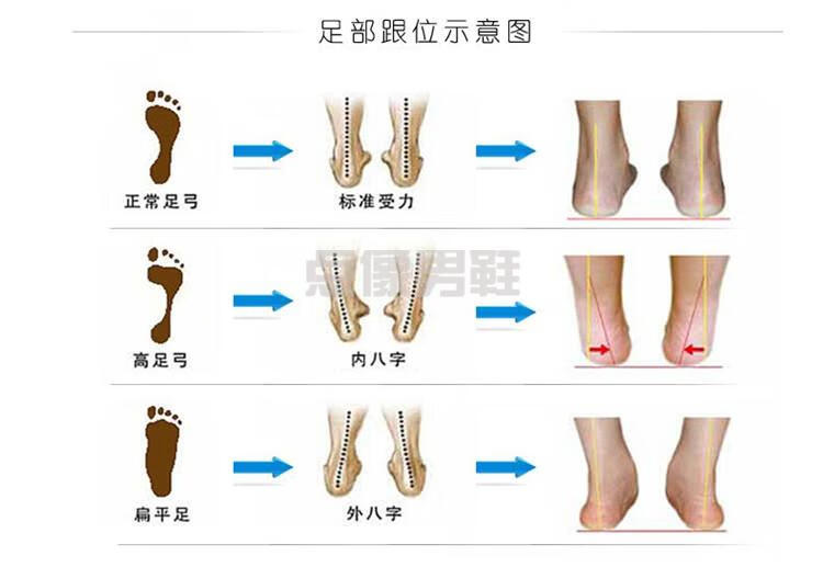 小孩子儿童扁平足弓支撑拖鞋矫腿型正足外翻八字轻便防滑亲子凉拖橙色