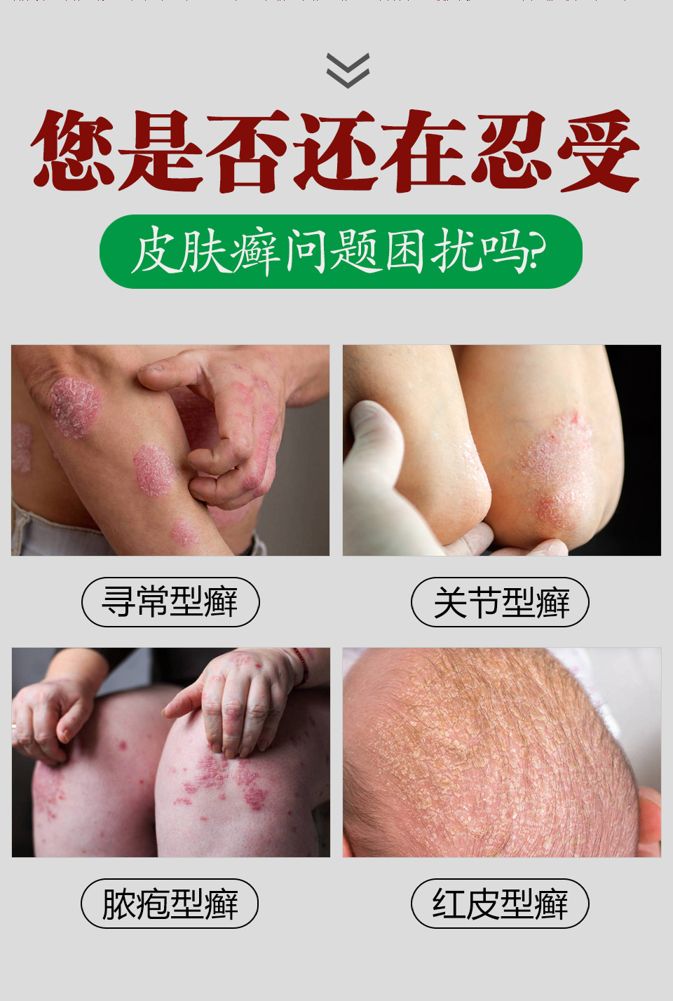 御医堂皮必康湿s疹牛皮瘙痒银x屑廯外用乳膏一盒装