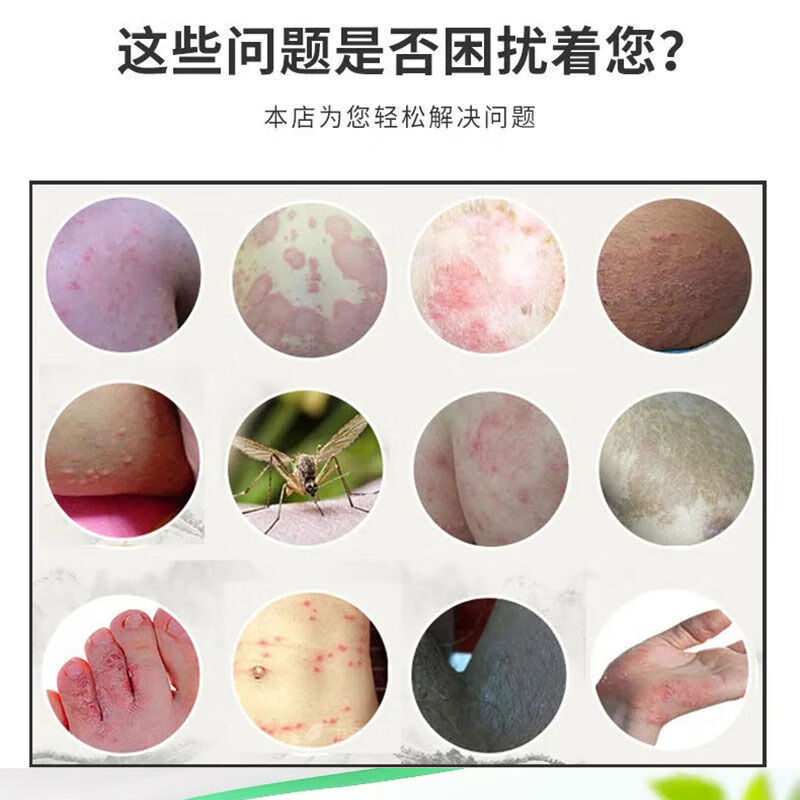 30g阴虱男女私处外用软膏1只体验装