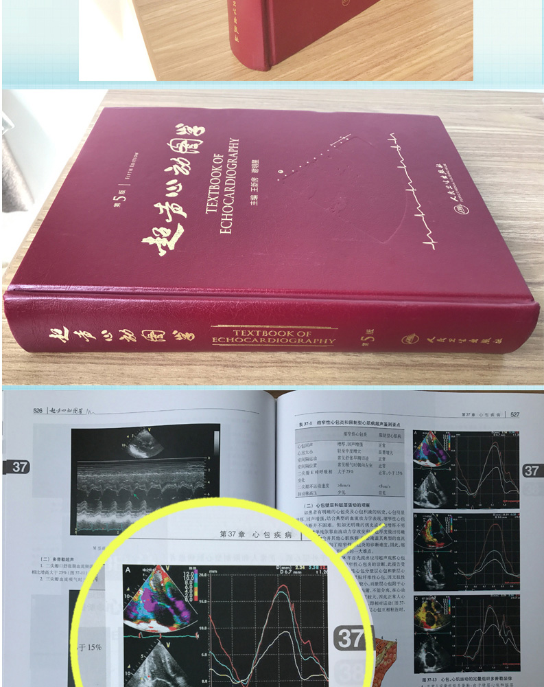 《正版超声心动图学(第5版)精装王新房谢图谱临床实用声心动图学诊断