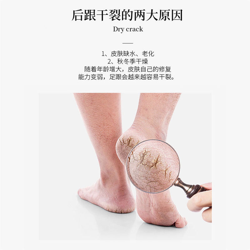 高品质男士夏款袜子双装男女夏季薄棉船袜足跟型全脚型防裂袜子足裂袜