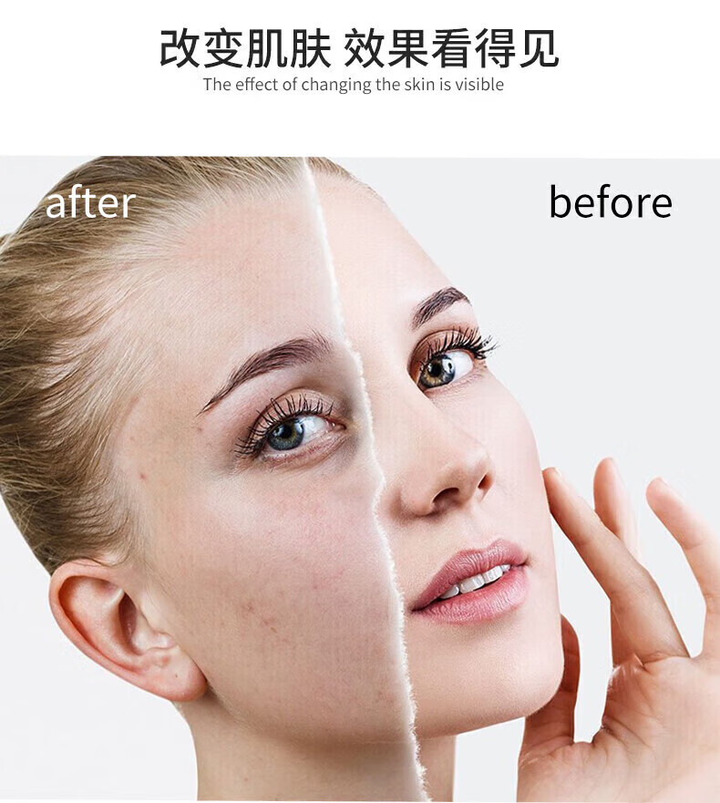 维怡美花开八度维怡美官1方正1品旗1舰根草根果123原液祛痘护肤套装系列 根草原液1号贈棉签 20ml 肌肤保