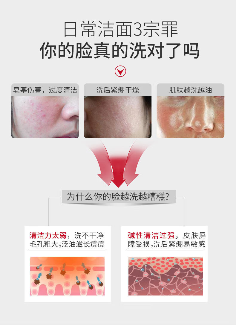 痘言洁面慕斯氨基酸洗面奶泡沫温和洁面深层清洁角质控油洗面奶比芭美