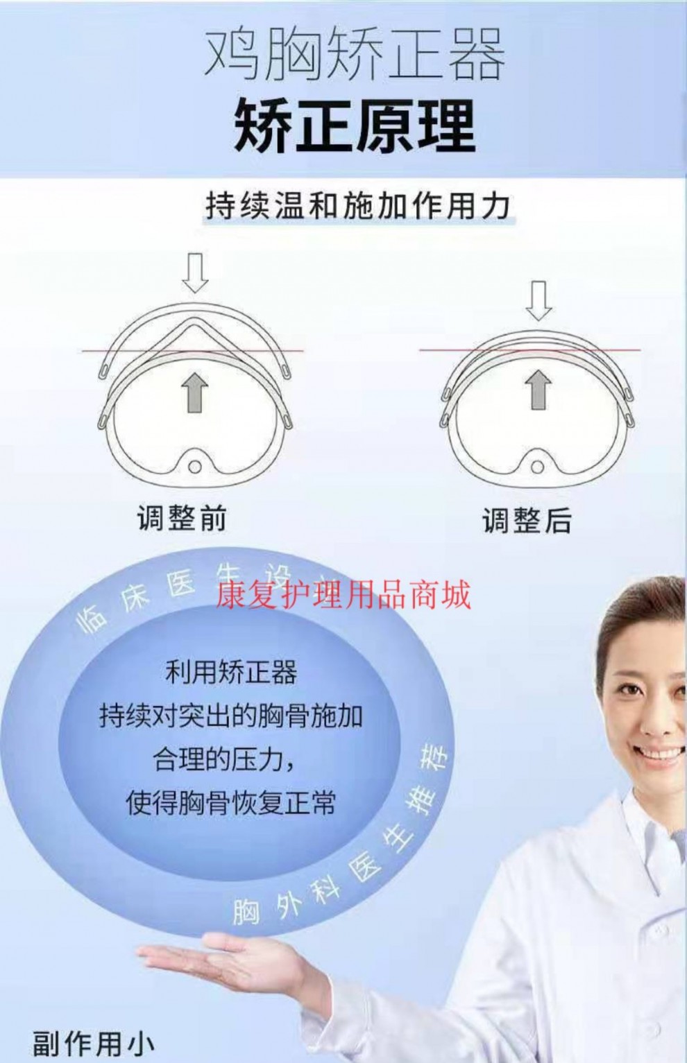 鸡胸器胸骨突出胸廓畸形胸部固定器胸围固定带前胸外翻矫形器