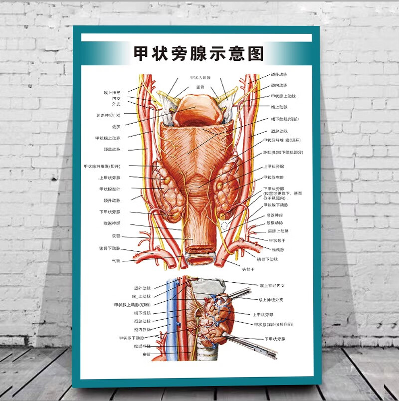 器官解剖医学教学海报墙贴画甲状腺前面观厚pp胶背面带胶4060厘米24寸
