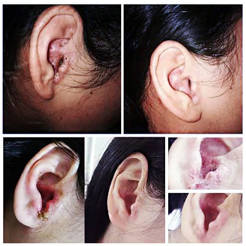 滴i耳i油人用中耳炎耳朵痒耳鸣洗耳液滴耳液成人儿童耳屎软化 滴i耳i