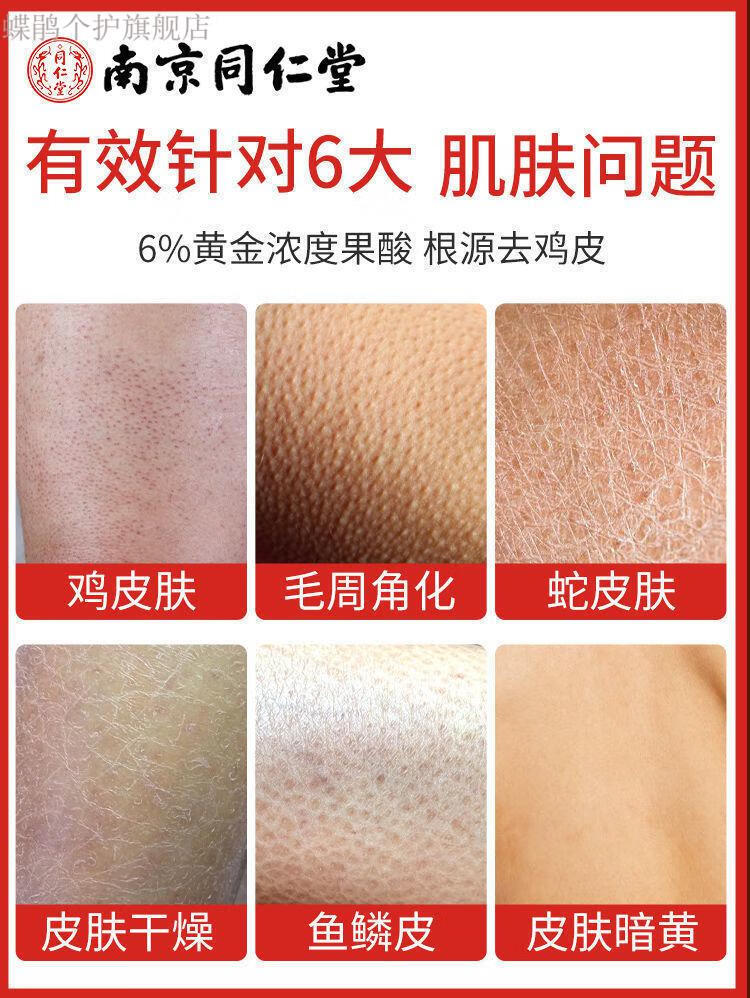 去除鸡皮蛇皮鱼鳞皮肤(去除鸡皮蛇皮鱼鳞皮肤用什么药)
