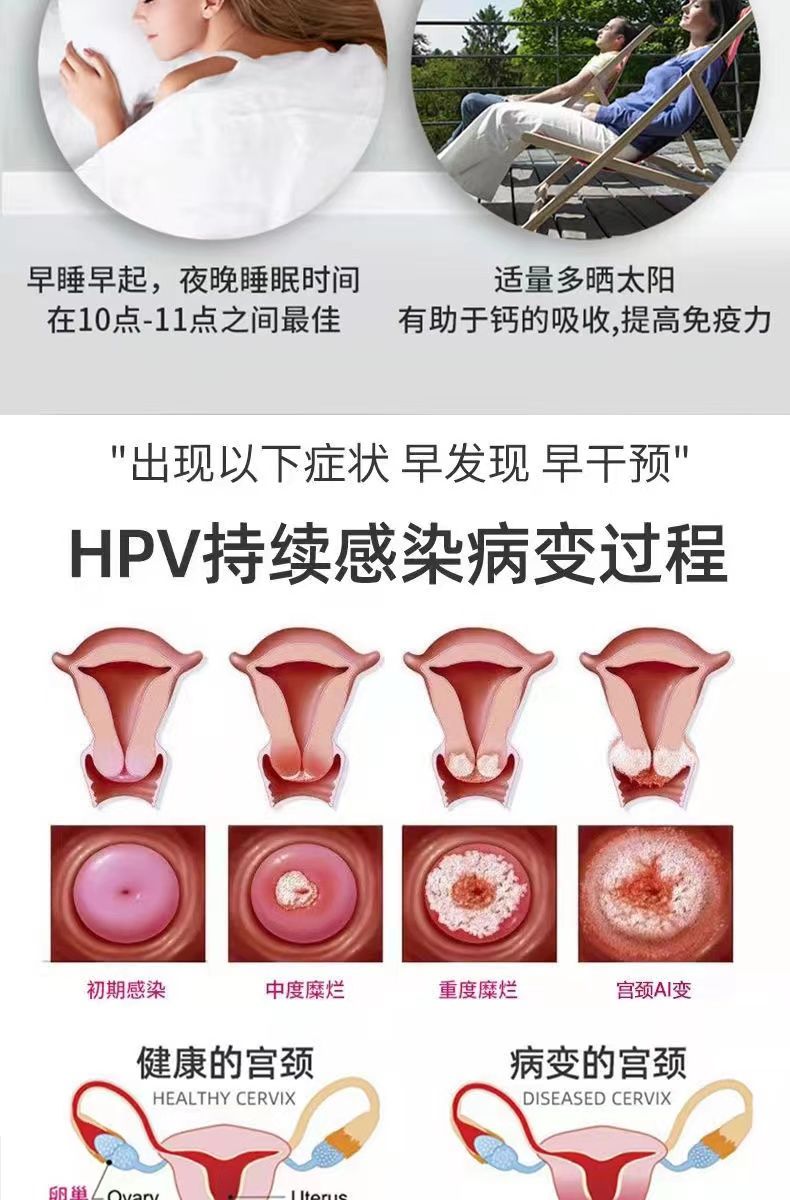 干扰素hpv高危妇科宫颈炎尖锐湿疣病毒感染重组干扰重度 抗hpv型葡