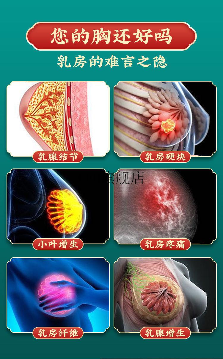 卓宣本草贴增生散结帖结节硬块小叶增生肿块乳房囊肿胀痛疏通 1盒装