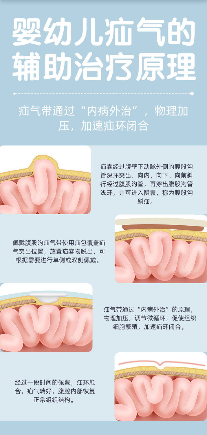 婴儿腹股沟疝图片