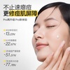 Yusu Anti-Acne Big Bulb 3.0 Chen Meng recommends staying up late for acne, aunt acne skin care products, student acne gifts