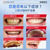 XIBELAON German brand whitening toothpaste removes yellowing, stains, inhibits bacteria, removes bad breath and stones, top ten well-known brands, contains fluoride and protects gums