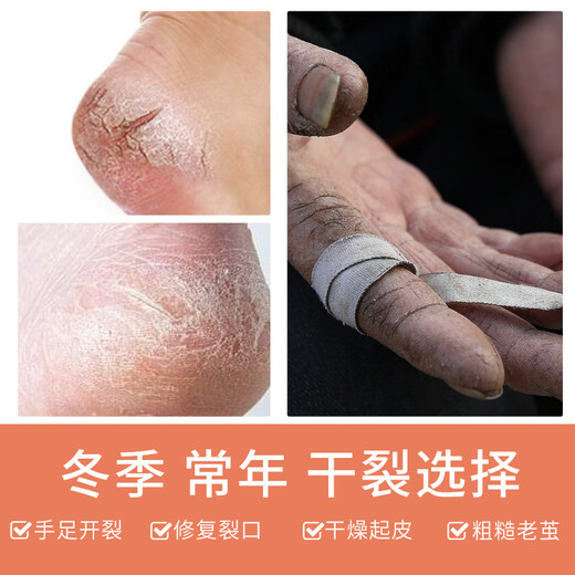 Supreme Banana Cream Thai Anti-Crack Foot Cream Foot Cream Cracked Heels Cracked Hands and Feet Moisturizing Crown Brand 120g 1 Box (6 Bottles) Banana Cream Original Import