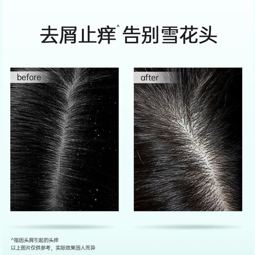 Ziyuan Anti-Dandruff Shampoo Dew Silicona Control de aceite Fluffy Anti-Ict Washing Men and Women Tea Seed Oil Remover 400ml