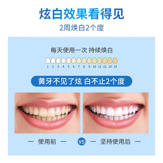 Cailiko tooth patch whitening teeth yellow teeth black teeth tea stains black white 5D white tooth film patch available for men and women. Buy three Song Erfa 5 boxes