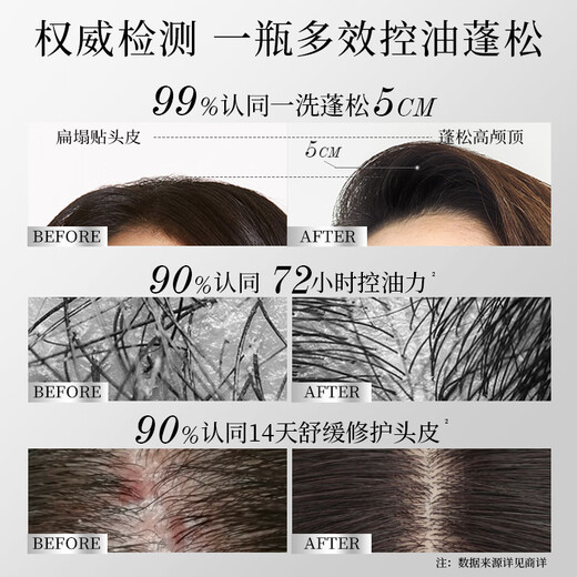 滋源持久控油洗发水露蓬松去屑止痒洗头膏男女士无硅油第1绿极光400g