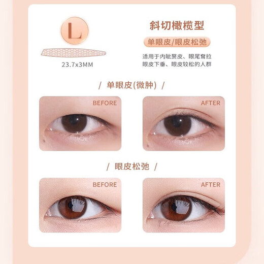 AKF double eyelid patch, invisible, natural, traceless, non-warping, skin color, lace mesh, double eyelid patch for men and women, bevel-cut olive-shaped L 120 patch