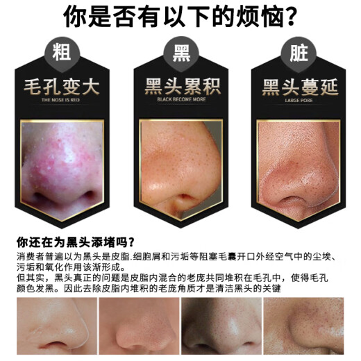 Marbella mayllie blackhead removal nose patch 5p (tear-off nose patch set T zone care shrink pores available for men and women)