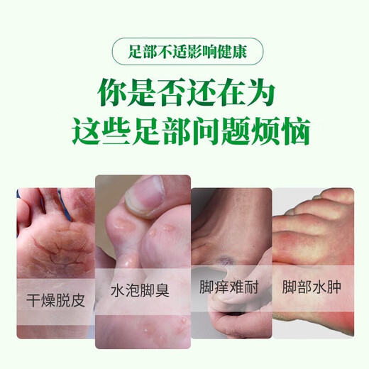 Chunchuntang Yunnan Materia Medica athlete's foot spray sweaty feet, smelly feet, itchy feet, soaked feet, peeling shoes, smelly external use set