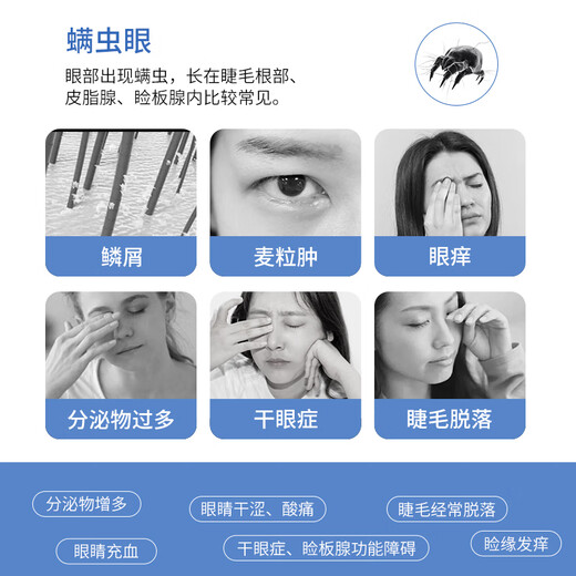FIT MOMENT4松油醇除螨湿巾眼部专用茶树精油眼睛清洁湿巾痒护眼除螨虫20片