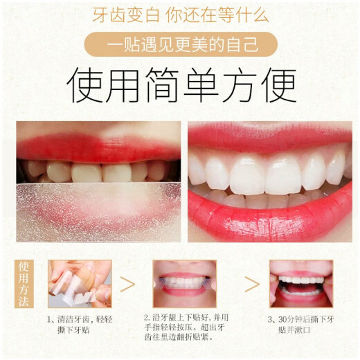 Meimuwanxi Teeth Patch, beautiful and whitening teeth, removing yellow teeth, whitening teeth, fresh breath, 14 pieces/box of four boxes of dental patches (moderate yellow teeth) [56 pieces]