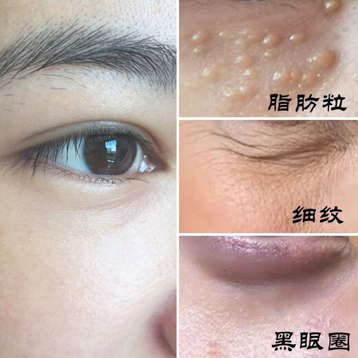 九叶草眼霜保湿补水提拉紧致抗眼纹眼部男女士精华30g