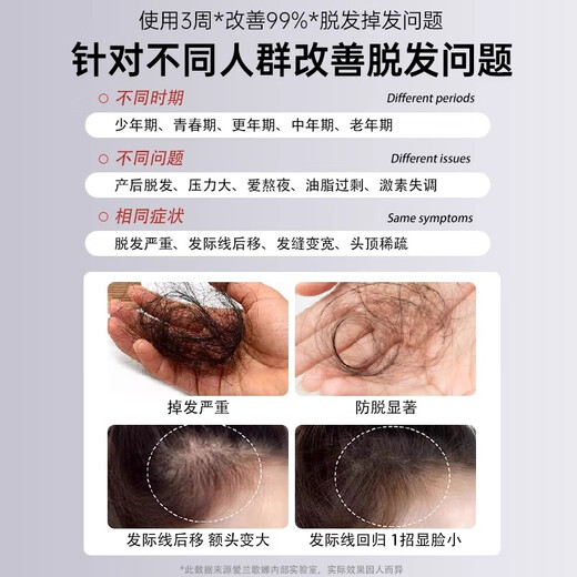 Ailangna Ginger Shampoo Anti-degeneration Hair Control Oil Anti-dandruff Anti-Itch Washing Cream for Men and Women Silicone Oil Shampoo 808ml