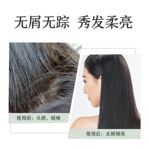 100-year hair moisturizing shampoo anti-dandruff anti-itch shampoo shower gel value set wash 750ML + 700g long-lasting fragrance