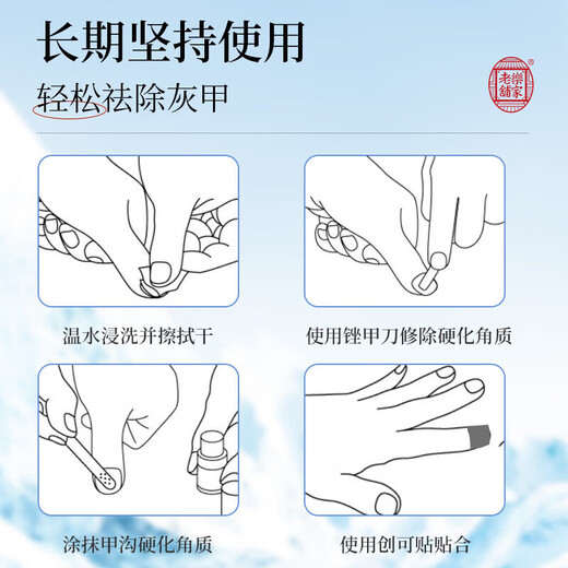 Lejia old store Nanjing Tongrentang special plaster for treating severe onychomycosis, nail fungus infection onychomycosis antibacterial liquid