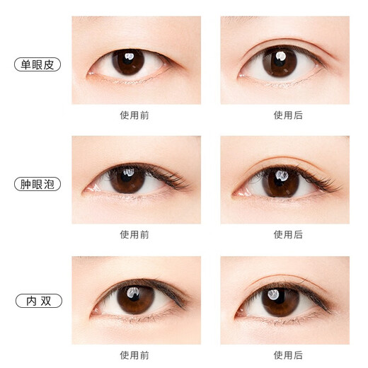 Youyi (unny club) double eyelid stickers for women are naturally invisible and traceless to enlarge the eyes, sticky and long-lasting, light and thin simulated lace S short and narrow type - 100 pieces