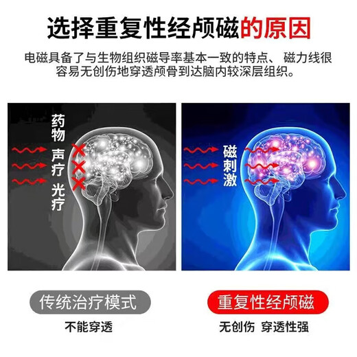 Dispositivo de terapia de estimulación magnética transcraneal para accidente cerebrovascular infarto de accidente