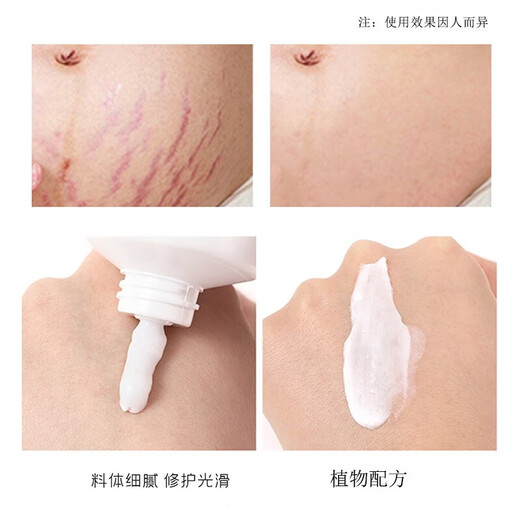 Pink Princess Pregnancy Cream, Pregnancy Marks, Pregnant Women's Growth and Obesity, Special Textile Care Oil, Postpartum Repair, Prevention, Fading, Necessary Pregnancy Supplies, One Bottle of Pregnancy Marks Repair Cream