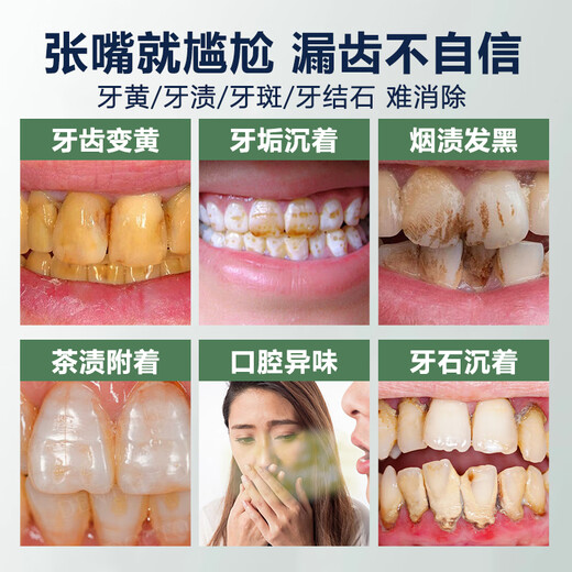 BEAI Whitening Tooth Cleaning Powder Pearl Tooth Cleaning Powder to remove odor, bad breath, remove yellowing, remove tooth stains, remove smoke stains and stones 50g