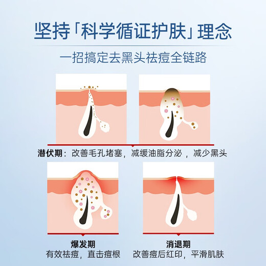 Moisturizing 15% azelaic acid gel 5g acne removal and blackhead acne removal salicylic acid fine pores 15% azelaic acid gel [Experience package] 5g