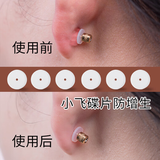 Sha Yanxi anti-proliferation small flying saucer navel nail earrings lip nail tongue nail anti-invagination food grade silicone ear piercing ear bone nail spacer small flying saucer 3+fixed ring 3+storage box+alcohol cotton